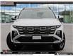 2026 Hyundai Tucson Hybrid Ultimate (Stk: U461617) in Brooklin - Image 2 of 25