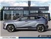 2026 Hyundai Kona Electric Preferred w/Ultimate Package Two-Tone (Stk: 7-1775) in Whitby - Image 3 of 25