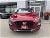 2021 Hyundai Kona 2.0L Preferred (Stk: 28395T) in Newmarket - Image 6 of 11