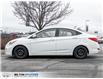 2016 Hyundai Accent SE (Stk: 087584A) in Milton - Image 3 of 23