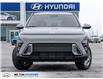 2026 Hyundai Kona 2.0L Essential (Stk: 453458) in Milton - Image 2 of 24