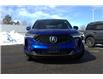 2022 Acura RDX  (Stk: DZ1438A) in Ottawa - Image 2 of 16