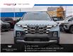 2022 Hyundai Santa Cruz Ultimate (Stk: R28360A) in Ottawa - Image 5 of 18