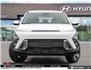 2026 Hyundai Kona 2.0L Preferred (Stk: U452042) in Brooklin - Image 2 of 26