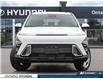 2026 Hyundai Kona 2.0L Essential (Stk: 7-1807) in Whitby - Image 2 of 26