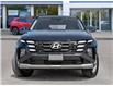 2026 Hyundai Tucson Preferred (Stk: 26I2101) in Aurora - Image 2 of 22