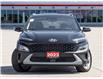 2023 Hyundai Kona 2.0L Preferred Sun & Leather Package (Stk: 2314533A) in North York - Image 3 of 26