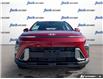 2024 Hyundai Kona 2.0L Preferred (Stk: 1005) in Kitchener - Image 2 of 24