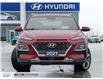 2021 Hyundai Kona 1.6T Ultimate w/Red Colour Pack (Stk: 704634) in Milton - Image 2 of 26
