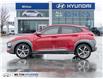 2021 Hyundai Kona 1.6T Ultimate w/Red Colour Pack (Stk: 704634) in Milton - Image 3 of 26