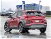 2021 Hyundai Kona 1.6T Ultimate w/Red Colour Pack (Stk: 704634) in Milton - Image 5 of 26