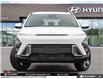2026 Hyundai Kona 2.0L Preferred (Stk: U354532) in Brooklin - Image 2 of 26