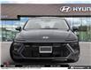 2026 Hyundai Sonata N Line (Stk: A542999) in Brooklin - Image 2 of 22