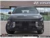 2026 Hyundai Kona 2.0L Preferred (Stk: U389474) in Brooklin - Image 2 of 26