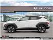 2026 Hyundai Kona 2.0L Preferred w/Trend Package (Stk: U406398) in Brooklin - Image 3 of 25
