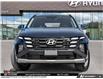 2026 Hyundai Tucson Preferred (Stk: U458414) in Brooklin - Image 2 of 25