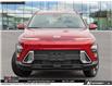 2026 Hyundai Kona 2.0L Preferred w/Trend Package (Stk: U417720) in Brooklin - Image 2 of 25