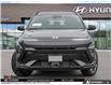 2026 Hyundai Kona 1.6T N Line Ultimate (Stk: U399125) in Brooklin - Image 2 of 25