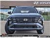 2026 Hyundai Tucson Preferred (Stk: U473809) in Brooklin - Image 2 of 26