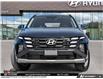 2026 Hyundai Tucson Preferred (Stk: U475867) in Brooklin - Image 2 of 25