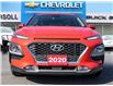 2020 Hyundai Kona  (Stk: 26260A) in Ingersoll - Image 2 of 27