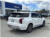 2024 Hyundai Palisade Ultimate Calligraphy (Stk: 261834A) in Aurora - Image 3 of 17