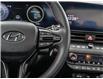 2023 Hyundai Elantra N Line Ultimate (Stk: U440036T) in Brooklin - Image 15 of 29 2023 Hyundai Elantra N Line Ultimate (Stk: U440036T) in Brooklin - Image 15 of 29
