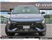 2026 Hyundai Kona 1.6T N Line Ultimate (Stk: U464460) in Brooklin - Image 2 of 25