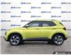 2020 Hyundai Venue Ultimate w/Grey-Lime Interior (Stk: 1096) in Kitchener - Image 3 of 24 2020 Hyundai Venue Ultimate w/Grey-Lime Interior (Stk: 1096) in Kitchener - Image 3 of 24