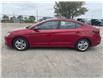 2020 Hyundai Elantra Preferred (Stk: 106169A) in St. Thomas - Image 2 of 18 2020 Hyundai Elantra Preferred (Stk: 106169A) in St. Thomas - Image 2 of 18