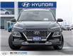 2021 Hyundai Kona 1.6T Ultimate (Stk: 691547) in Milton - Image 2 of 26