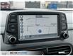 2021 Hyundai Kona 1.6T Ultimate (Stk: 691547) in Milton - Image 12 of 26