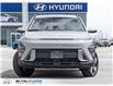 2026 Hyundai Kona 2.0L Preferred (Stk: 375282) in Milton - Image 2 of 22 2026 Hyundai Kona 2.0L Preferred (Stk: 375282) in Milton - Image 2 of 22