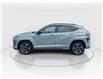2025 Hyundai Kona 1.6T N Line (Stk: 16105537A) in Markham - Image 5 of 29 2025 Hyundai Kona 1.6T N Line (Stk: 16105537A) in Markham - Image 5 of 29
