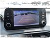 2022 Hyundai Santa Fe HEV Luxury (Stk: 042035) in Milton - Image 11 of 30 2022 Hyundai Santa Fe HEV Luxury (Stk: 042035) in Milton - Image 11 of 30