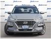 2021 Hyundai Kona 1.6T Ultimate (Stk: 98290) in London - Image 2 of 26
