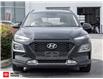 2018 Hyundai Kona 2.0L Preferred (Stk: 157411) in Milton - Image 2 of 23 2018 Hyundai Kona 2.0L Preferred (Stk: 157411) in Milton - Image 2 of 23