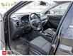 2018 Hyundai Kona 2.0L Preferred (Stk: 157411) in Milton - Image 8 of 23 2018 Hyundai Kona 2.0L Preferred (Stk: 157411) in Milton - Image 8 of 23