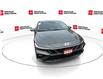 2025 Hyundai Elantra HEV Luxury (Stk: 10U6667) in Markham - Image 3 of 32