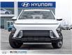2026 Hyundai Kona 2.0L Preferred (Stk: 465205) in Milton - Image 2 of 24