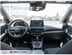 2023 Hyundai Kona 1.6T N Line (Stk: 999667) in Milton - Image 23 of 24