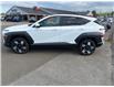 2025 Hyundai Kona  (Stk: 25589A) in Oak Bay - Image 3 of 9