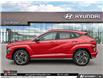 2026 Hyundai Kona 1.6T N Line Ultimate (Stk: U472468) in Brooklin - Image 3 of 22