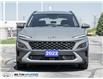 2022 Hyundai Kona 2.0L Preferred Sun & Leather Package (Stk: 874440) in Milton - Image 2 of 24