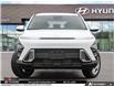 2026 Hyundai Kona 2.0L Essential (Stk: U475256) in Brooklin - Image 2 of 26