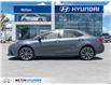 2017 Toyota Corolla SE (Stk: 830865) in Milton - Image 3 of 26