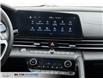 2025 Hyundai Elantra Luxury (Stk: 919421) in Milton - Image 28 of 28