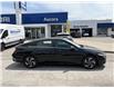 2025 Hyundai Elantra HEV Luxury (Stk: 26U1314) in Aurora - Image 3 of 21