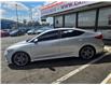 2018 Hyundai Elantra Sport Tech (Stk: 2605269) in Waterloo - Image 2 of 26