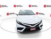2022 Toyota Camry SE (Stk: 10121154A) in Markham - Image 3 of 28
